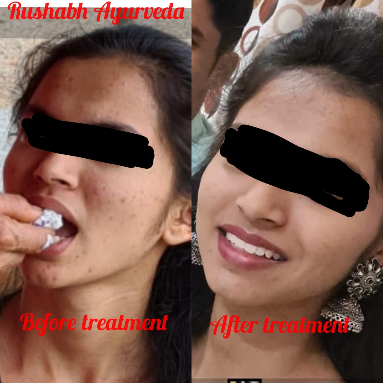 Patient testimonial � Rushabh Ayurveda