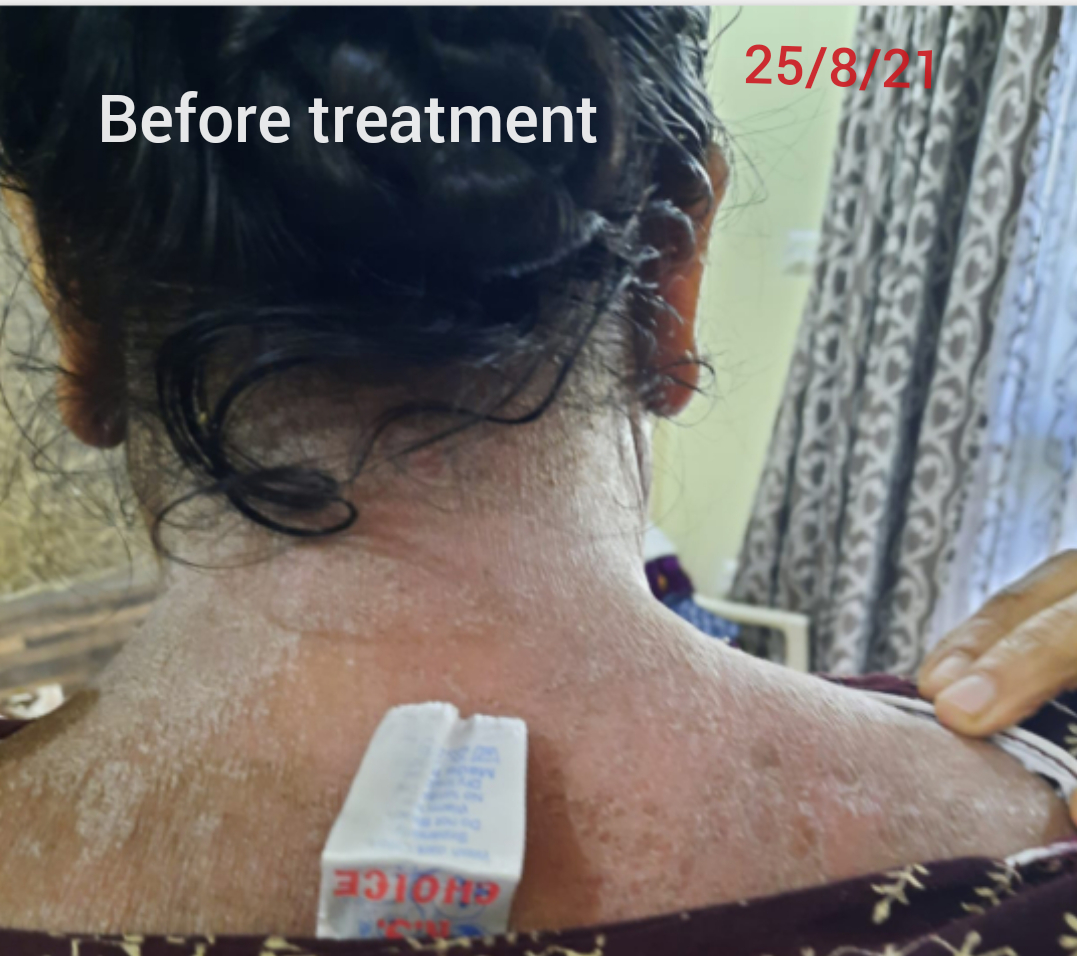 Patient testimonial 5 â€“ Rushabh Ayurveda